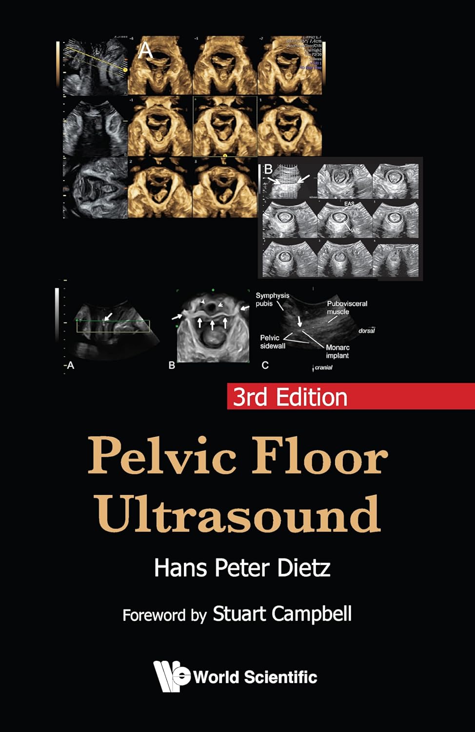 Pelvic Floor Ultrasound, 3rd Edition (EPUB)