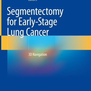 Segmentectomy for Early-Stage Lung Cancer (Original PDF from Publisher)