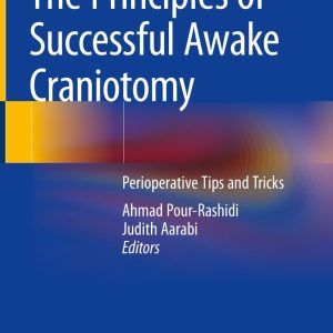 The Principles of Successful Awake Craniotomy (Original PDF from Publisher)