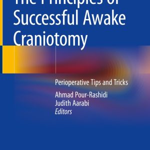 The Principles of Successful Awake Craniotomy (EPUB)