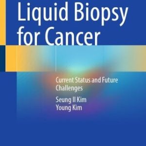 Liquid Biopsy for Cancer (EPUB)