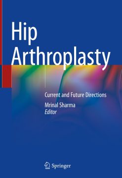 Hip Arthroplasty (EPUB)