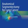 Anatomical Segmentectomy for Lung Cancer: Illustration and Videos (Original PDF from Publisher)