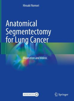 Anatomical Segmentectomy for Lung Cancer: Illustration and Videos (Original PDF from Publisher)