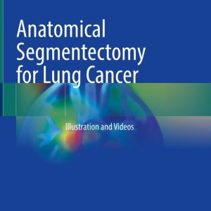 Anatomical Segmentectomy for Lung Cancer: Illustration and Videos (Original PDF from Publisher)