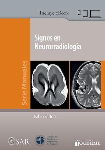 SIGNOS EN NEURORRADIOLOGIA (High Quality Image PDF)