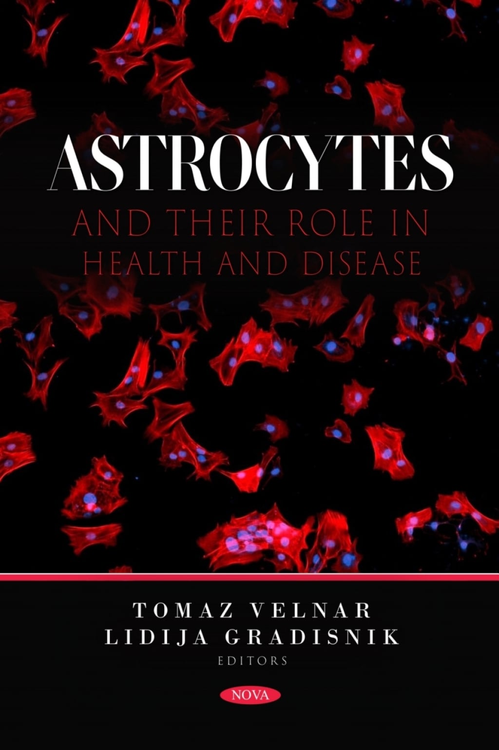 Astrocytes and Their Role in Health and Disease (Original PDF from Publisher)