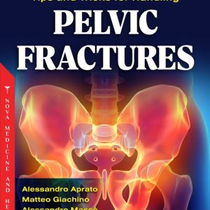 Tips and Tricks for Handling Pelvic Fractures (Original PDF from Publisher)