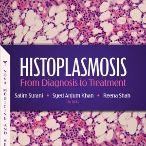 Histoplasmosis: From Diagnosis to Treatment (Original PDF from Publisher)