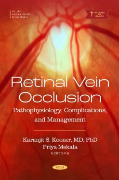 Retinal Vein Occlusion: Pathophysiology, Complications, and Management (Original PDF from Publisher)