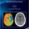 A Practical Guide to Comprehensive Stroke Care: Meeting Population Needs (Original PDF from Publisher)