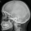 A teaching file of X rays and scans (EPUB)