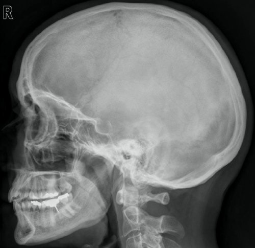 A teaching file of X rays and scans (EPUB)