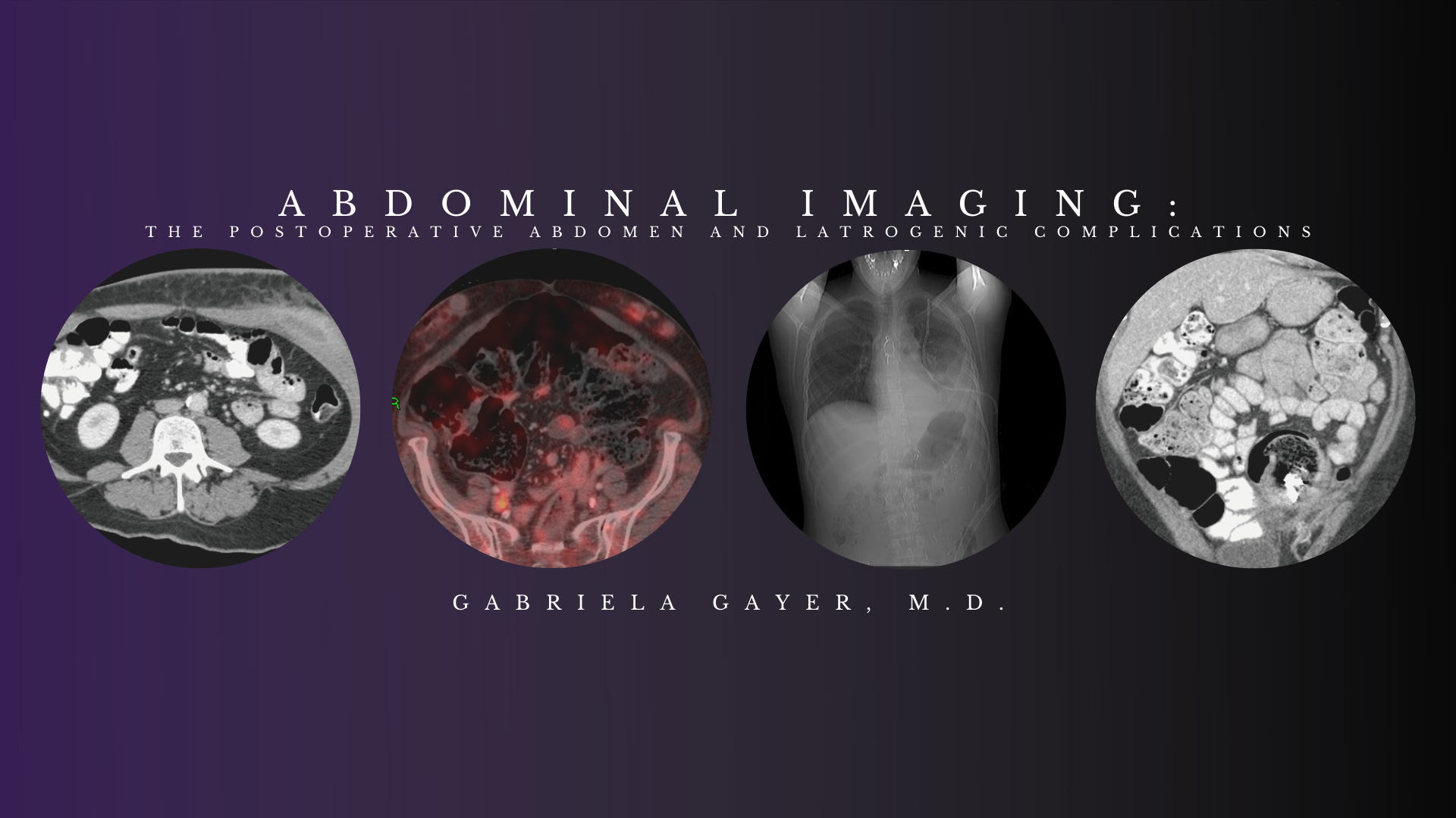 Abdominal Imaging – Gabriela Gayer, M.D. (CMEScience) (Videos)