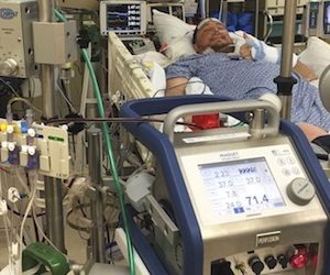 Adult ECLS Course – Innovative ECMO Concepts (Complete Contents)