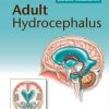 Adult Hydrocephalus (Cambridge Medicine)