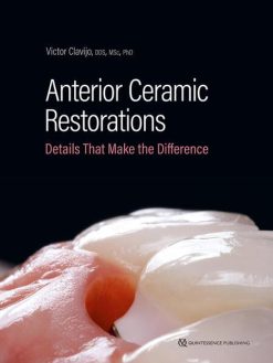 Anterior Ceramic Restorations: Details That Make the Difference (EPUB)