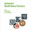 Anterior Skull Base Tumors (Advances in Oto-Rhino-Laryngology, Vol. 84) (Original PDF from Publisher)