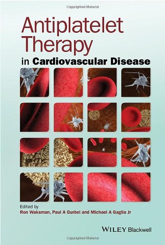 Antiplatelet Therapy in Cardiovascular Disease (Original PDF from Publisher)