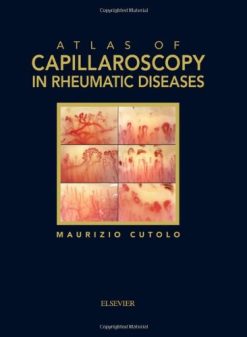 Atlas of Capillaroscopy in Rheumatic Diseases (Original PDF from Publisher)