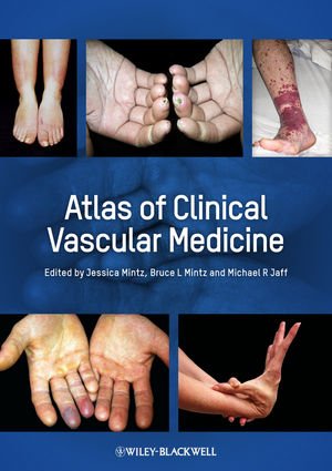 Atlas of Clinical Vascular Medicine (Original PDF from Publisher)