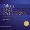 Atlas of EEG Patterns 2nd Edition (Original PDF from Publisher)