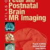 Atlas of Fetal and Postnatal Brain MR Imaging (Original PDF from Publisher)