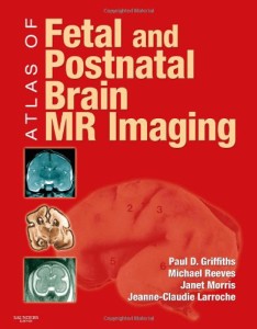 Atlas of Fetal and Postnatal Brain MR Imaging (Original PDF from Publisher)