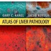 Atlas of Liver Pathology: Expert Consult – Online and Print, 3rd (Original PDF from Publisher)