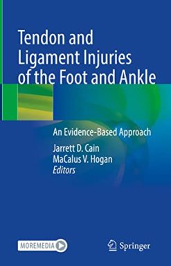 Tendon and Ligament Injuries of the Foot and Ankle: An Evidence-Based Approach (EPUB)