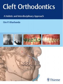 Cleft Orthodontics A Holistic and Interdisciplinary Approach (Original PDF from Publisher)