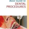 Basic Guide to Dental Procedures (Original PDF from Publisher)