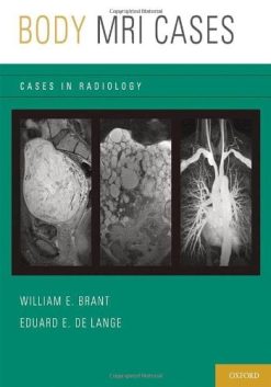 Body MRI Cases (Cases in Radiology)