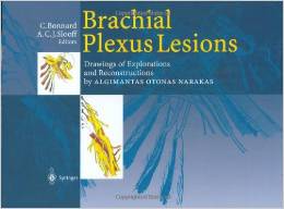 Brachial Plexus Lesions: Drawings of Explorations and Reconstructions by Algimantas Otonas Narakas