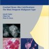 Breast Cancer: Early Detection with Mammography 1st edition (Original PDF from Publisher)