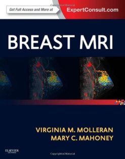 Breast MRI: Expert Consult: Online and Print (Original PDF from Publisher)