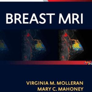 Breast MRI: Expert Consult: Online and Print (Original PDF from Publisher)
