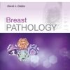 Breast Pathology – Expert Consult (Original PDF from Publisher)