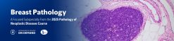 Breast Pathology – The Pathology of Neoplastic Diseases 2025 (Videos with subtitles + Slides)