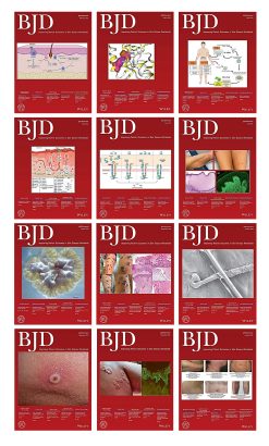British Journal of Dermatology 2022 Full Archives (True PDF)
