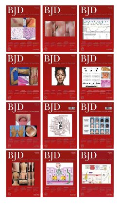 British Journal of Dermatology 2023 Full Archives (True PDF)