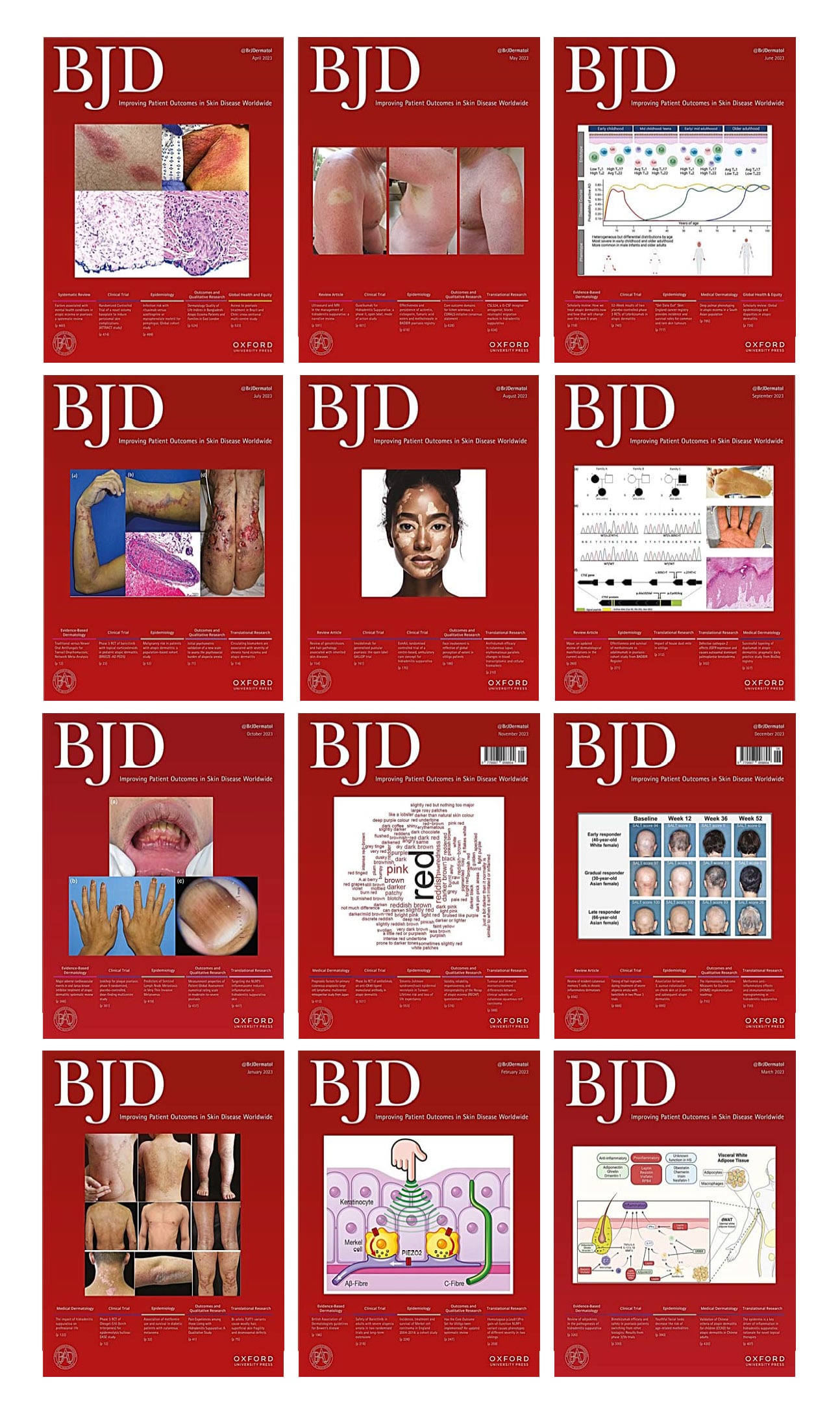 British Journal of Dermatology 2023 Full Archives (True PDF)