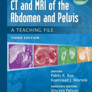 CT & MRI of the Abdomen and Pelvis: A Teaching File 3e (Original PDF from Publisher)