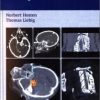 CT of the Head and Spine