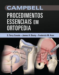 Campbell Procedimentos Essenciais em Ortopedia (Português) (PDF)