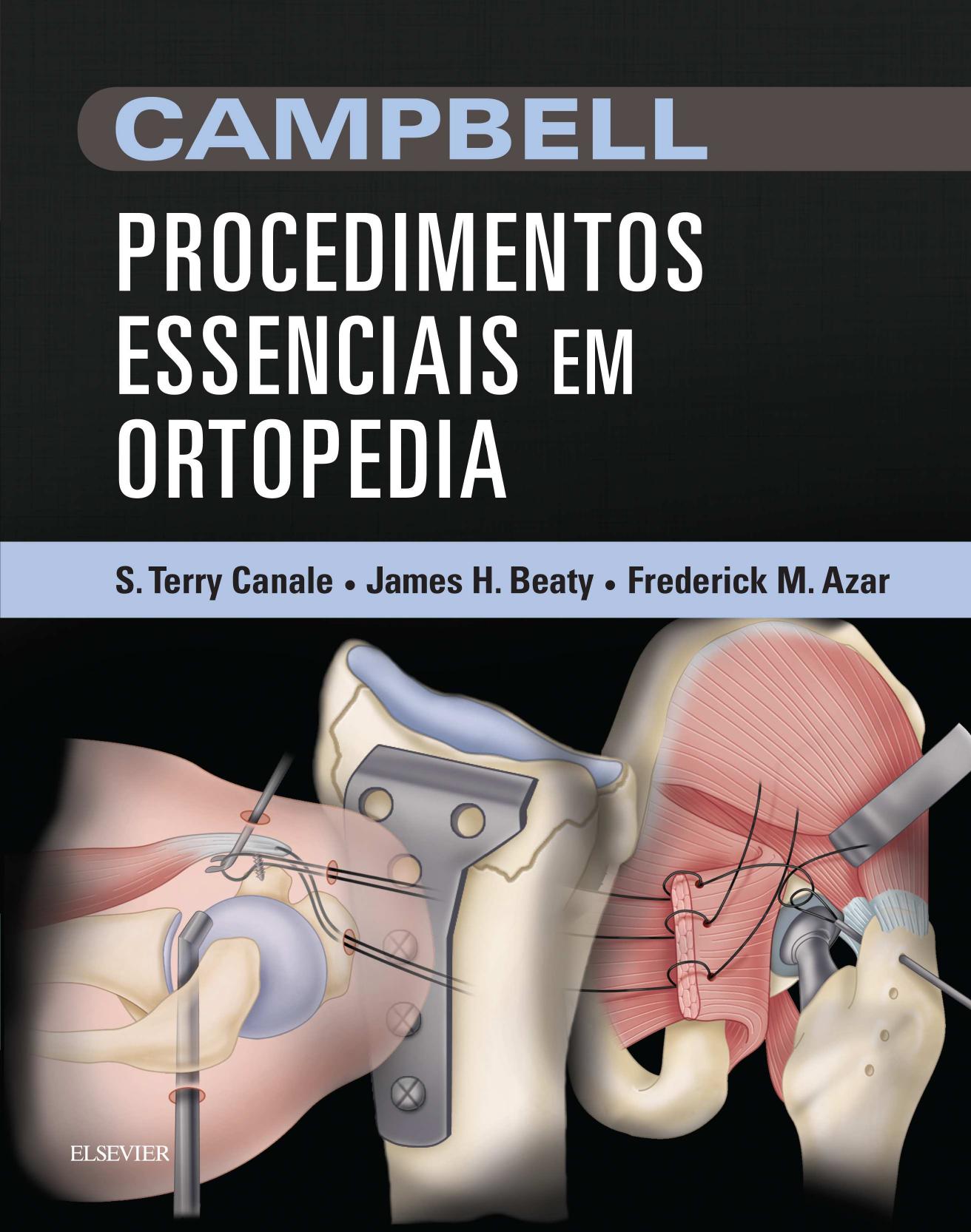 Campbell Procedimentos Essenciais em Ortopedia (Português) (PDF)