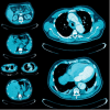 UCSF Abdominal and Thoracic Imaging 2025 (Videos + Slides PDFs)