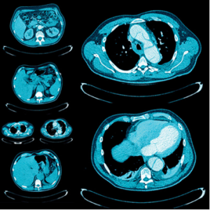 UCSF Abdominal and Thoracic Imaging 2025 (Videos + Slides PDFs)