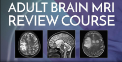 Adult Brain MRI Review Course – Online (Videos)