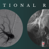 CME Science Interventional Radiology Stephen T. Kee, M.D 2021 (Videos)